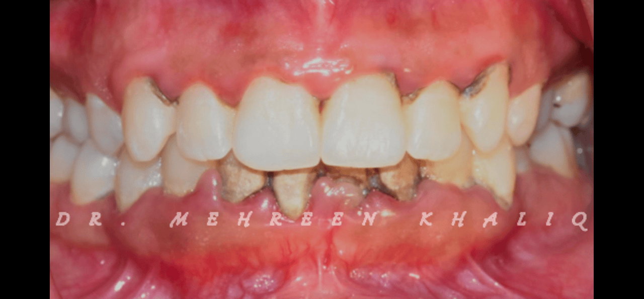 Before image