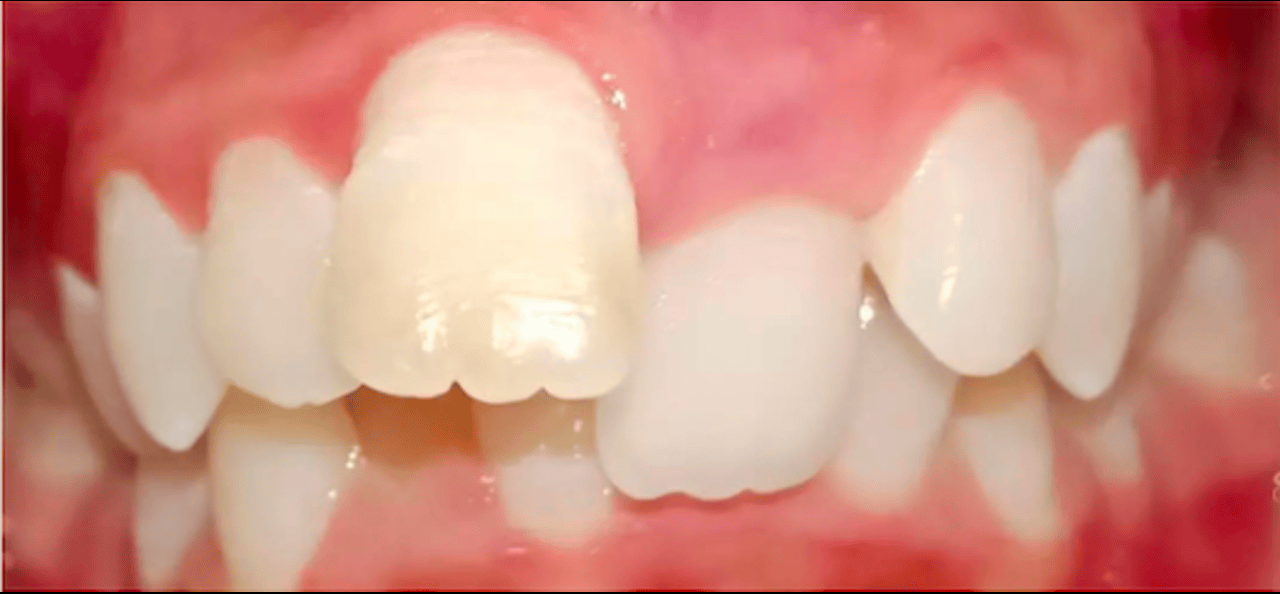 Before image