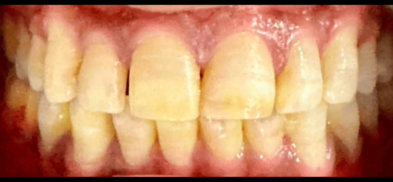 Before image