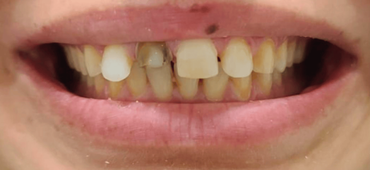 Before image
