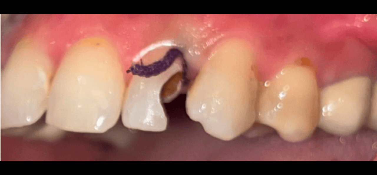 Before image
