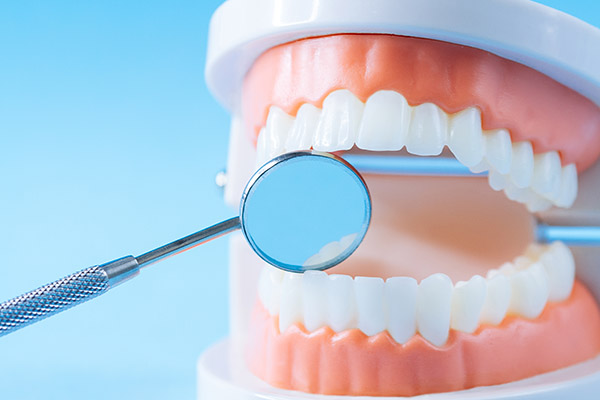 full mouth teeth replacement | dental avenue hospital