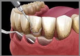 affordable dentist in lahore | dental avenue hospital