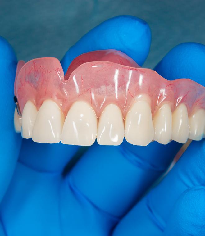Removable dentures cost – Affordable and comfortable denture solutions at Dental Avenue Hospital with expert dental care