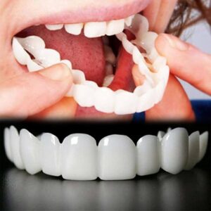 artificial Teeth Price in Lahore | Dental Avenue Hospital Lahore | Affordable Dental Implants & Dentures