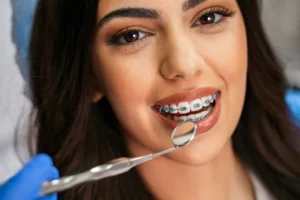 Coloured braces in Lahore at Dental Avenue Hospital – stylish orthodontic treatment for a confident smile