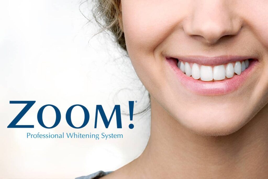 Zoom Teeth Whitening in Lahore at Dental Avenue Hospital – Best Dental Clinic for Teeth Whitening and Smile Makeover