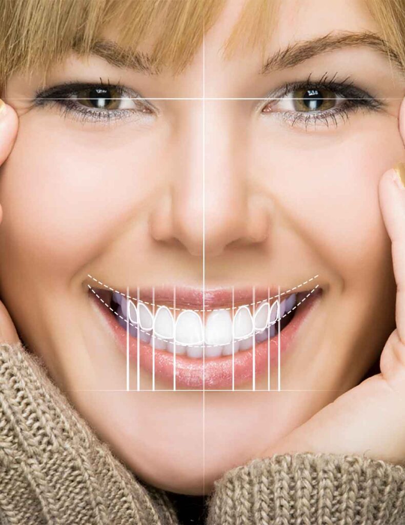 igital Smile Design treatment in Lahore using advanced 3D dental technology