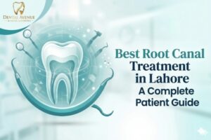 Best Root Canal Treatment in Lahore: A Complete Patient Guide