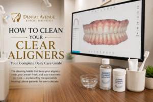 How to Clean Clear Aligners? The Ultimate Daily Care Guide