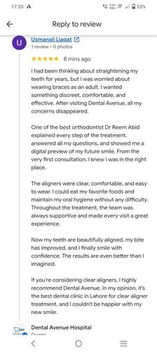 Before photo of Sobia's smile prior to clear aligner treatment